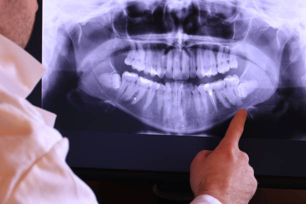 Best Pediatric Emergency Dentist in Saunders Lake, OR