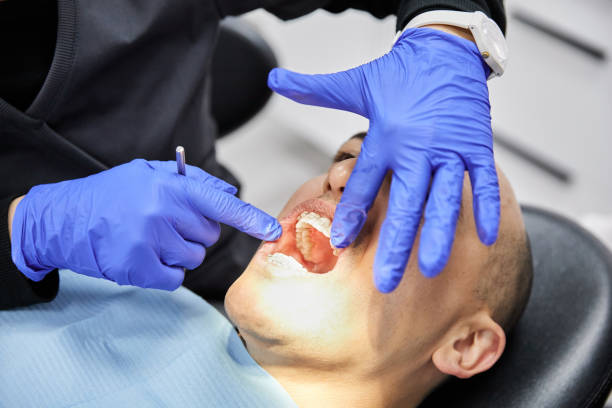 Best Emergency Dentist for Knocked-Out Tooth in Saunders Lake, OR