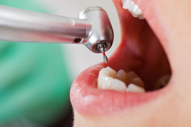Best Orthodontic Emergency Dentist in Saunders Lake, OR